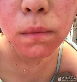 美容店纹唇爆料事件视频,揭秘纹唇背后的风险与真相