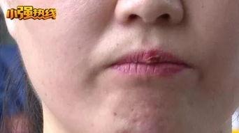 美容店纹唇爆料事件视频,揭秘纹唇背后的风险与真相  第3张